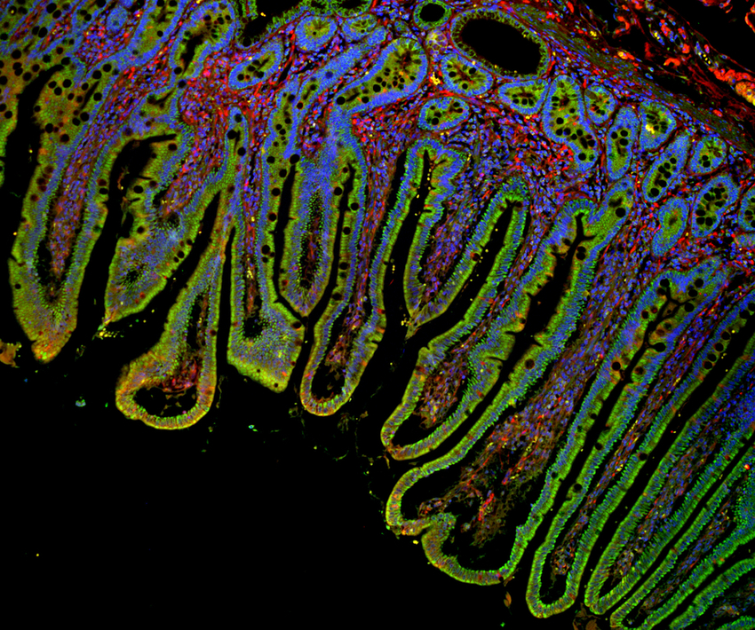 A photo of a cross-section of the mouse large intestine